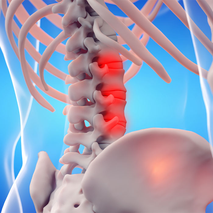 ankylosing spondylitis chiropractor in Colville WA