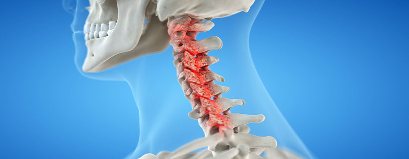 patient needing bone spur treatment in Colville