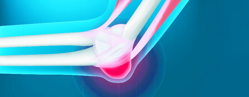 patient needing bursitis treatment in Colville