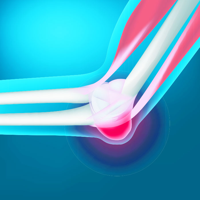 bursitis chiropractor in Colville WA