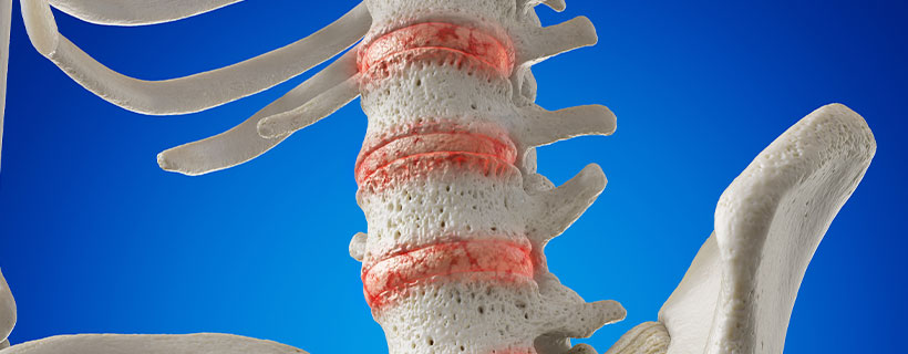 patient needing degenerative disc disease treatment in Colville