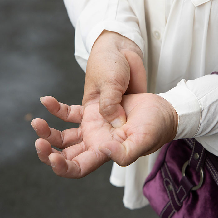 dupuytren contracture chiropractor in Colville WA