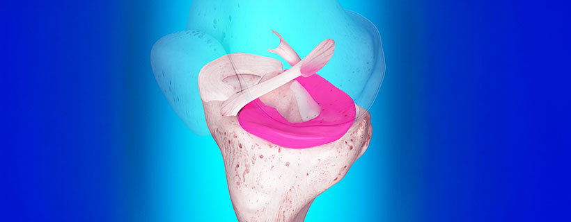 patient needing Ligamentitis treatment in Colville