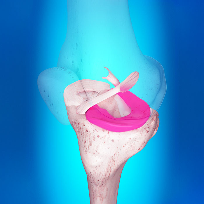 Ligamentitis chiropractor in Colville WA