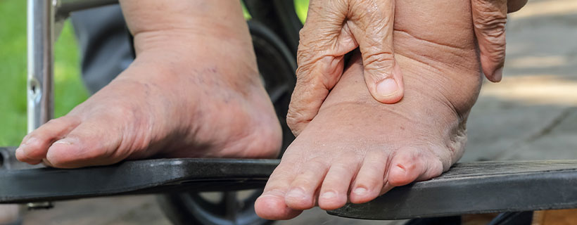 patient needing peripheral neuropathy treatment in Colville