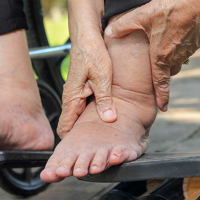 peripheral neuropathy relief in Colville WA