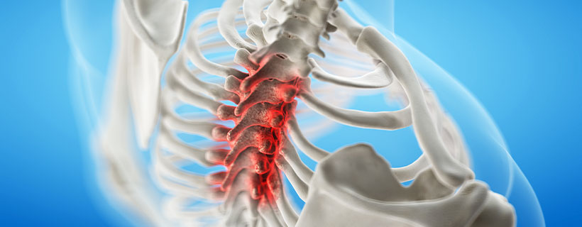 patient needing spinal stenosis treatment in Colville