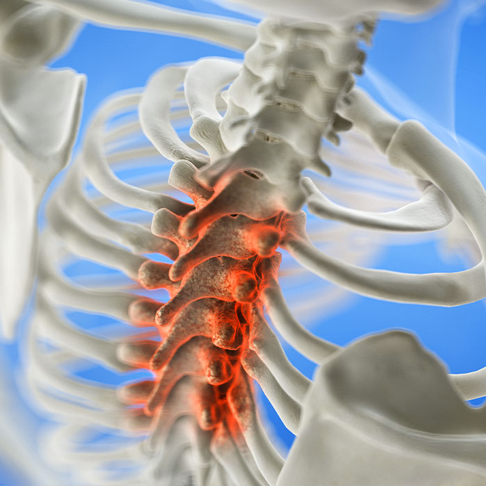spinal stenosis treatment in Colville WA