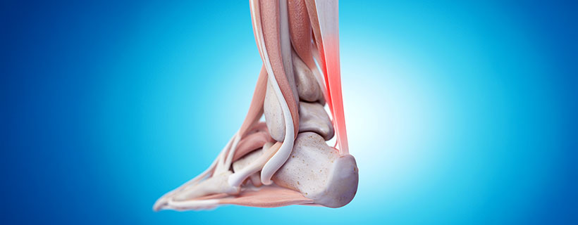 patient needing tendonitis treatment in Colville