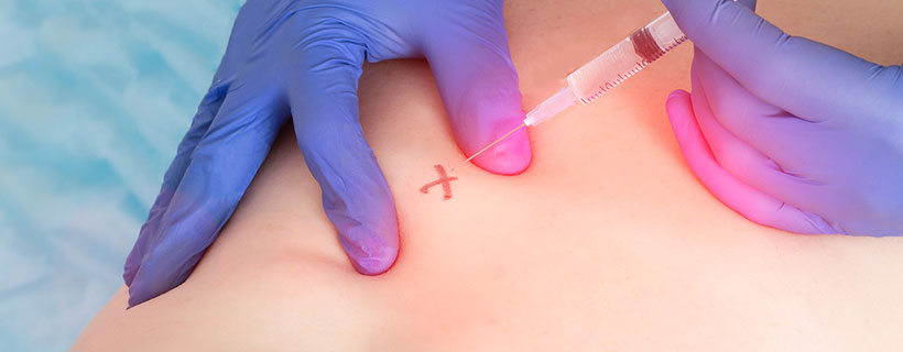 patient receiving Ozone Therapy in Colville